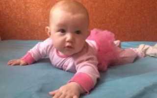 Лопоухость у новорожденных