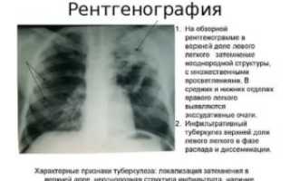 Описание рентгеновских снимков