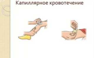 Как остановить капиллярное кровотечение