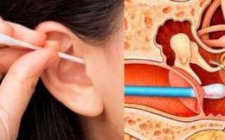 Когда сморкаюсь свистит в ухе