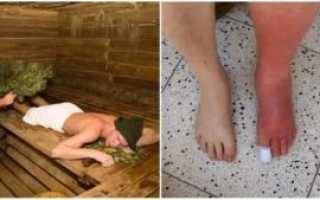 Можно ли после пневмонии ходить в баню