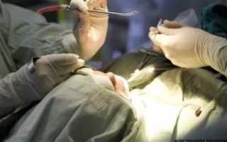 Инородное тело в пазухе носа операция