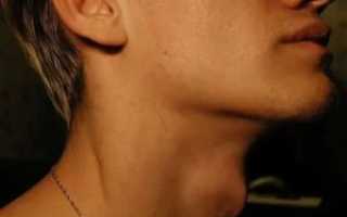 Почему растет кадык