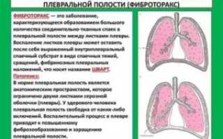 Плевральная шварта слева