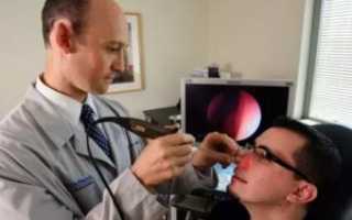 Метод профессора козлова лечение гайморита