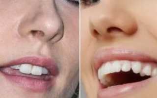 Волосы в носу у девушек как избавиться