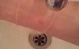 Можно ли купаться после укола